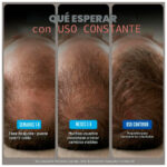 Kirkland Minoxidil 5% Caja Sellada x 6 Frascos – Tratamiento capilar de 6 meses - Imagen 6